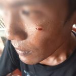 Astaga… Suami Hukum Tua Nain Satu Aniaya Warga Kembali di Polisikan
